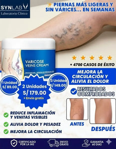 La Crema Nº1 para Reducir Venas Marcadas y Mejorar la Circulación