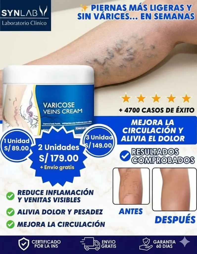 La Crema Nº1 para Reducir Venas Marcadas y Mejorar la Circulación