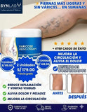 La Crema Nº1 para Reducir Venas Marcadas y Mejorar la Circulación